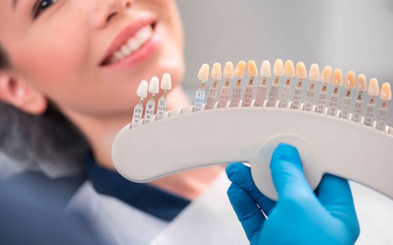 Dentist Holding Veneers